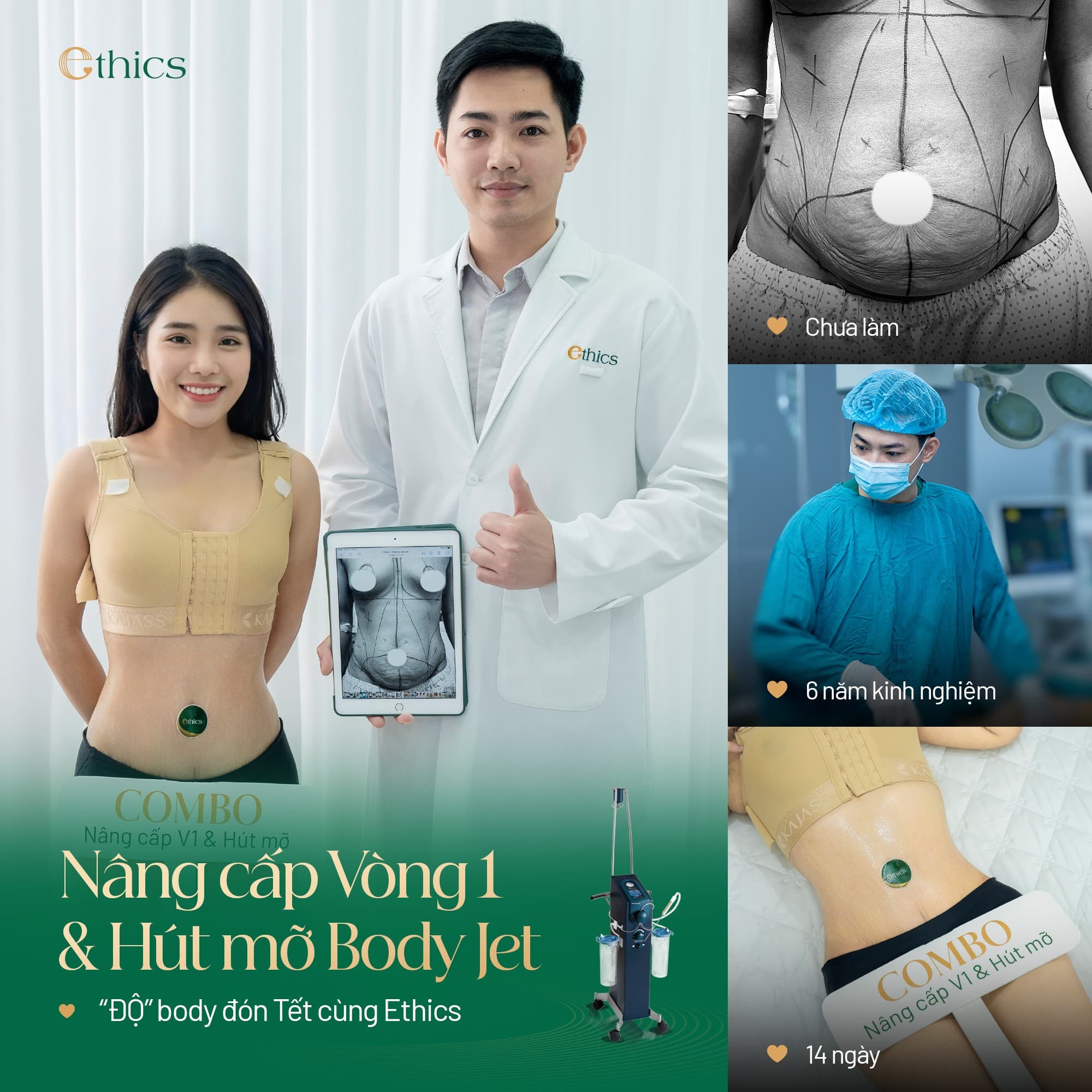 Nipple retraction/inverted nipple