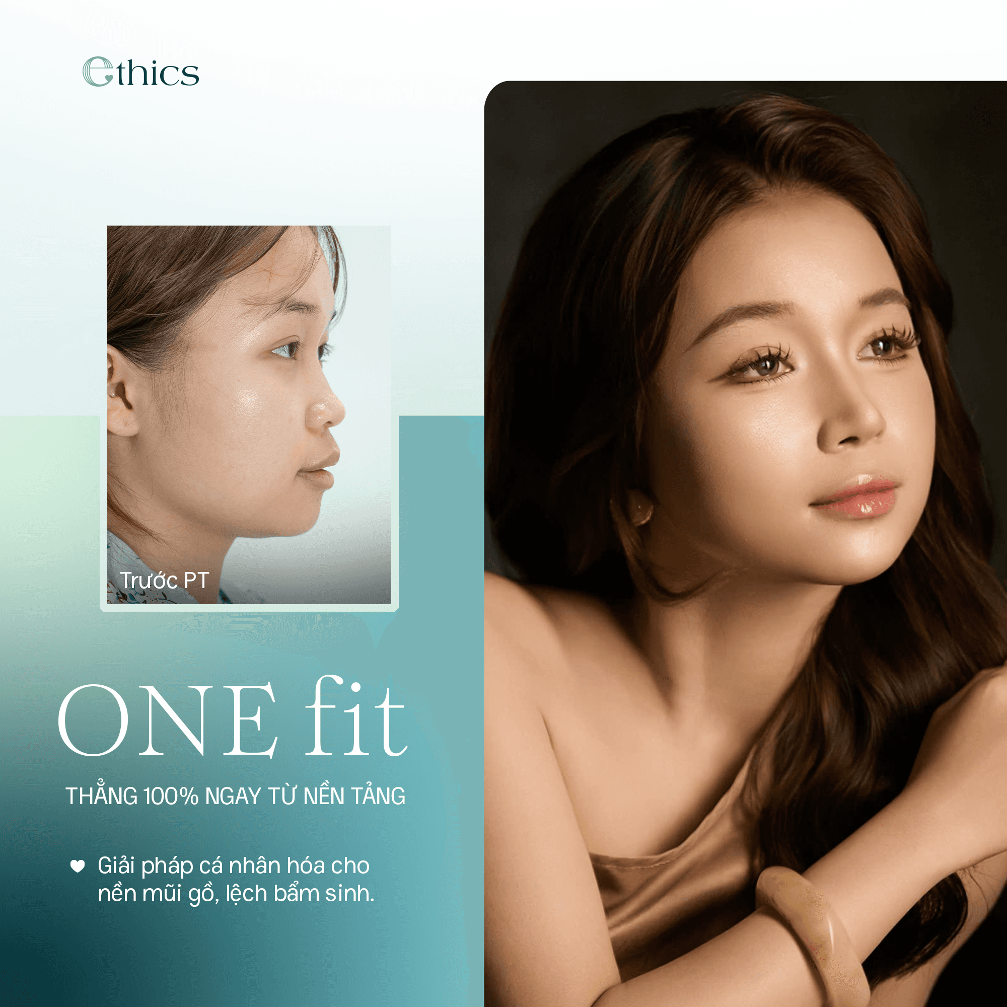 OneFit chin augmentation