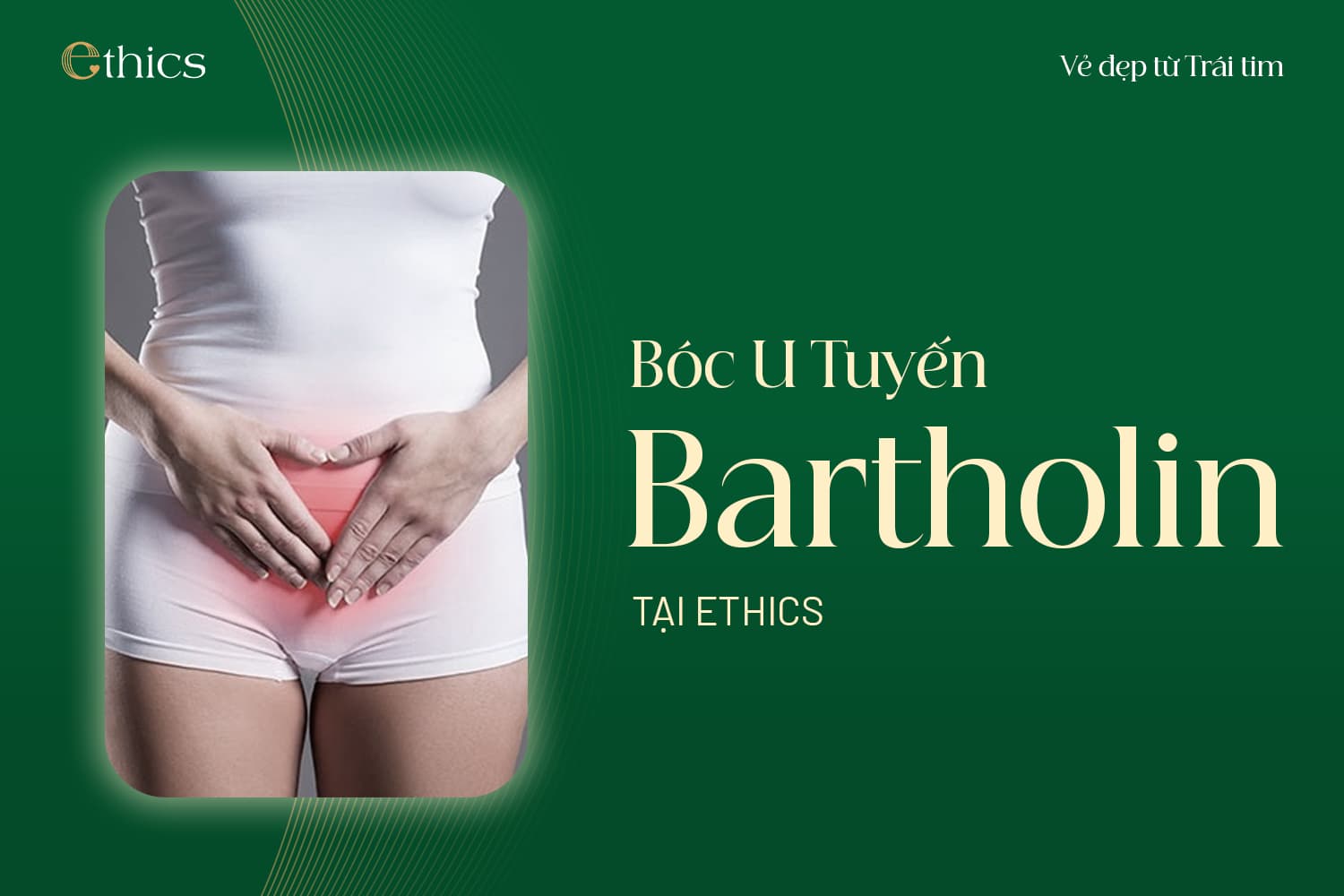 Bartholin Gland Cyst Removal