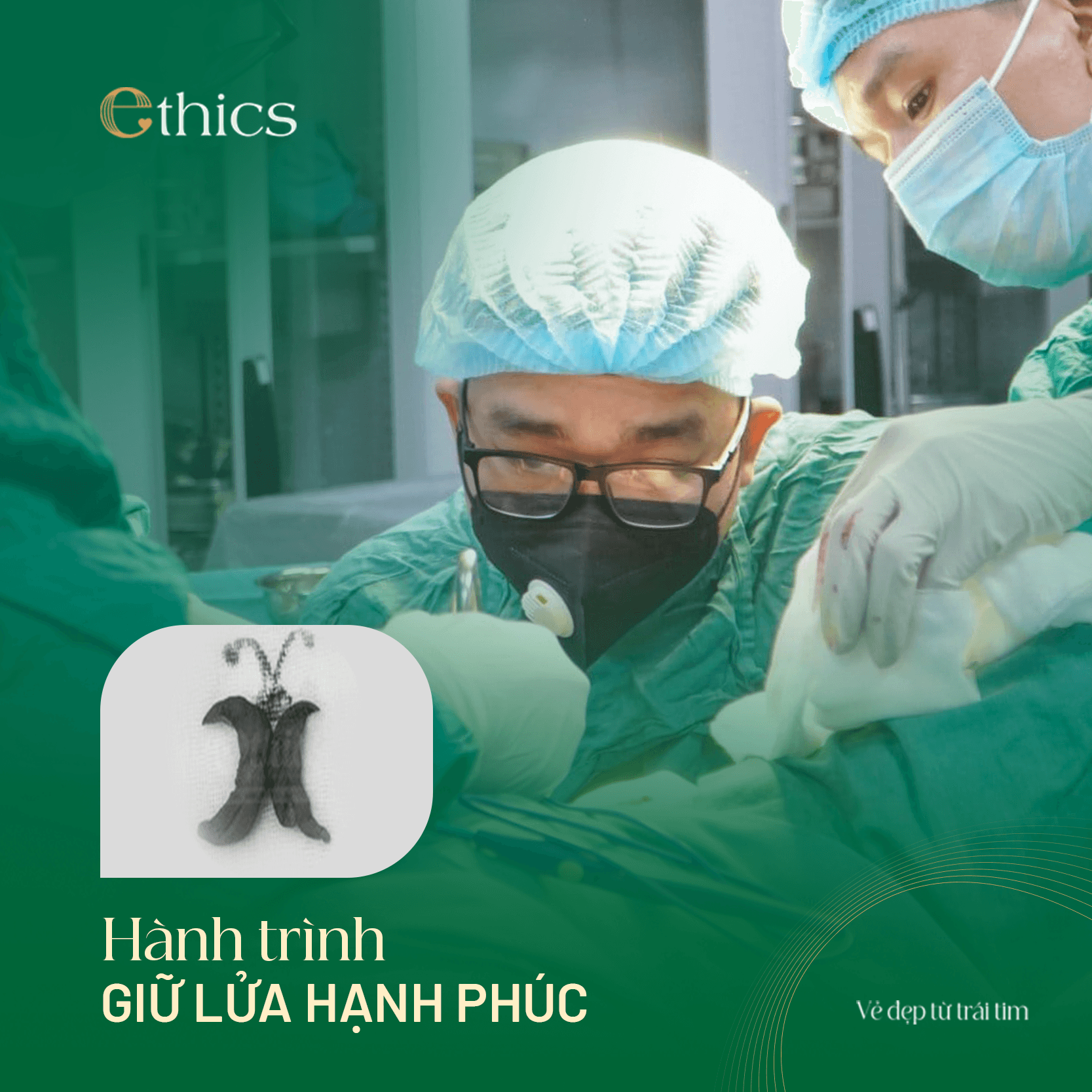 Labiaplasty (Inner Labia Reduction) Surgery