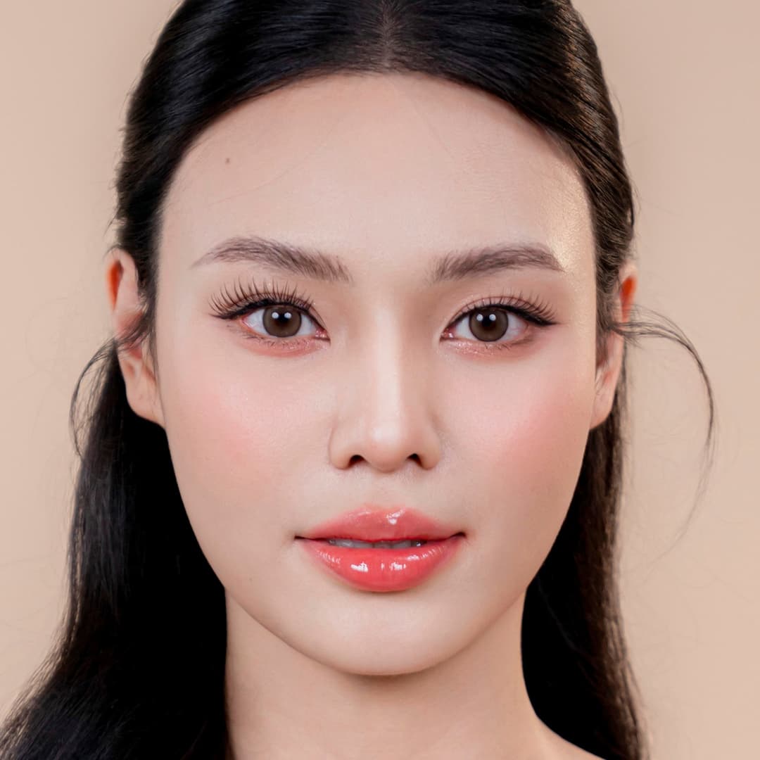 Client Luu Phuong Anh - After One Fit rhinoplasty intervention (close-up)