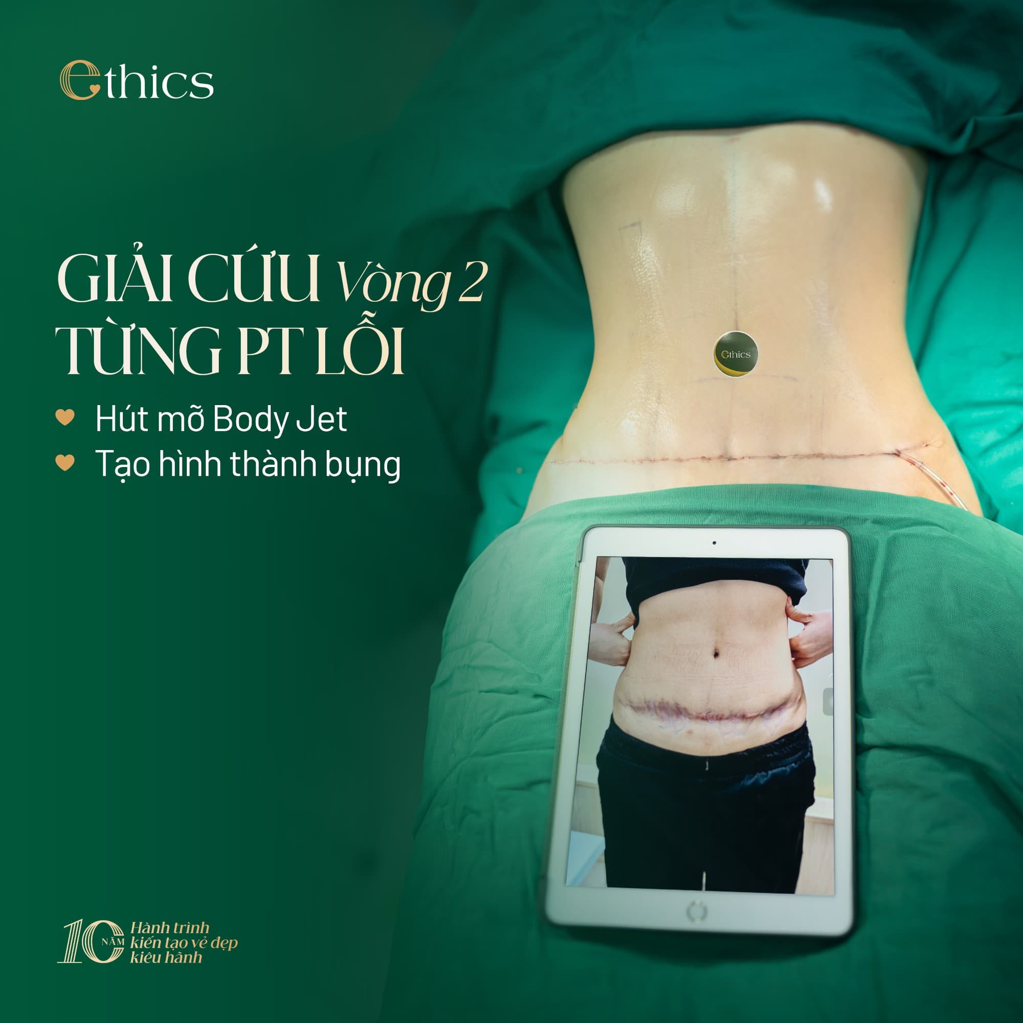 Overall figure – waist circumference of 100 cm